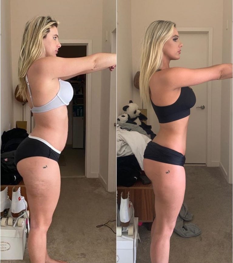 Lele Pons, antes y después (Instagram)