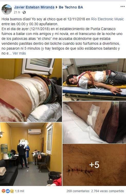 El descargo del joven agredido en un boliche de la Costanera