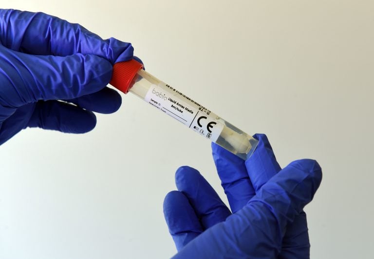 Test coronavirus (Photo by Christof STACHE / AFP)