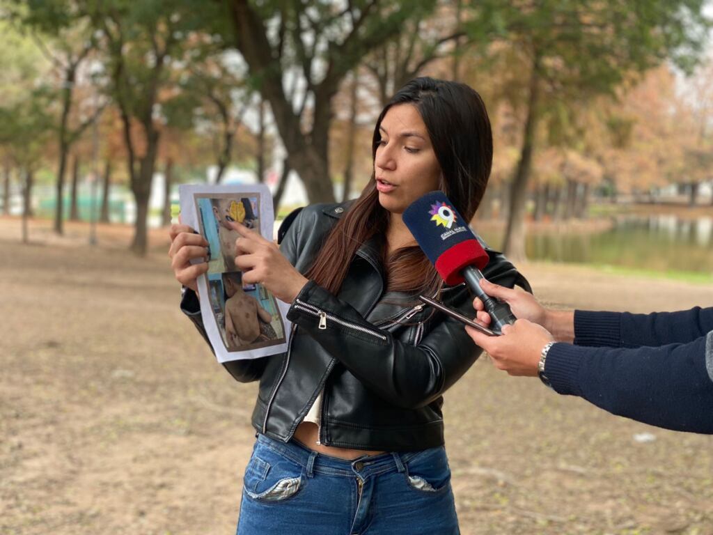 La madre del niño con mordeduras en la espalda.