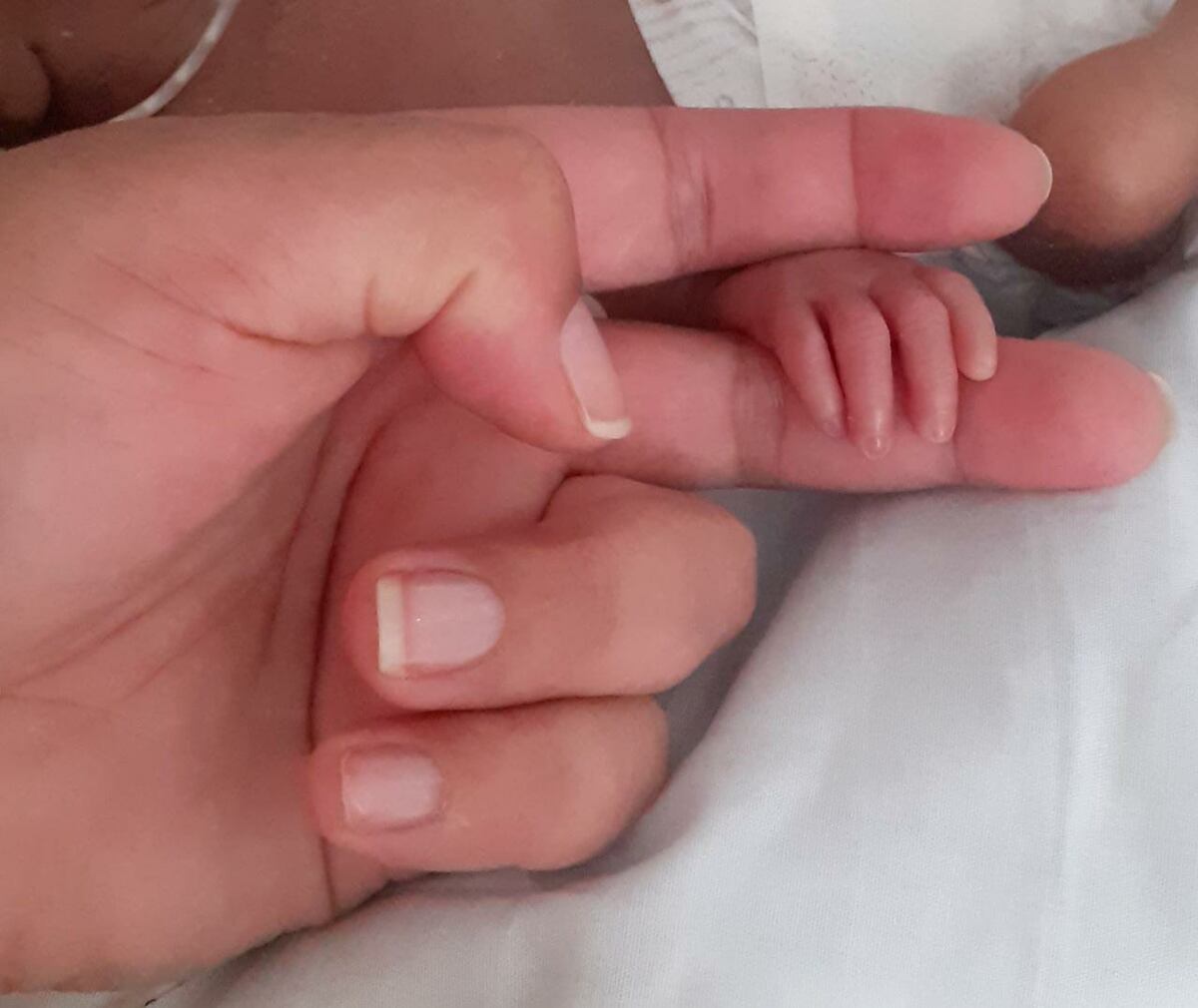 Todos por Bastian: nació prematuro y debe ser operado del corazón