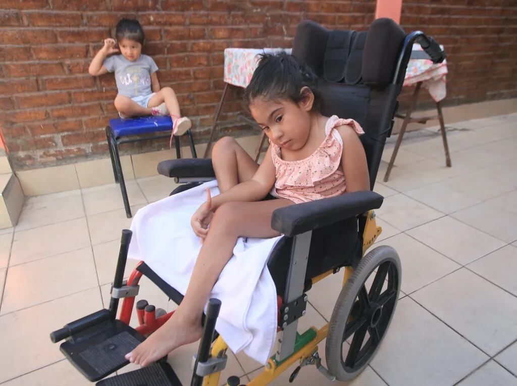 Allison, de 5 años con Encefalocele occipital e hidrocefalia.