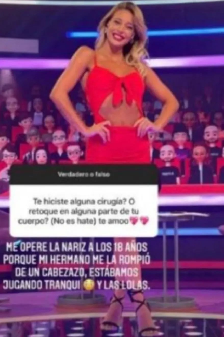 Sol Pérez habló en Instagram sobre sus cirugías.