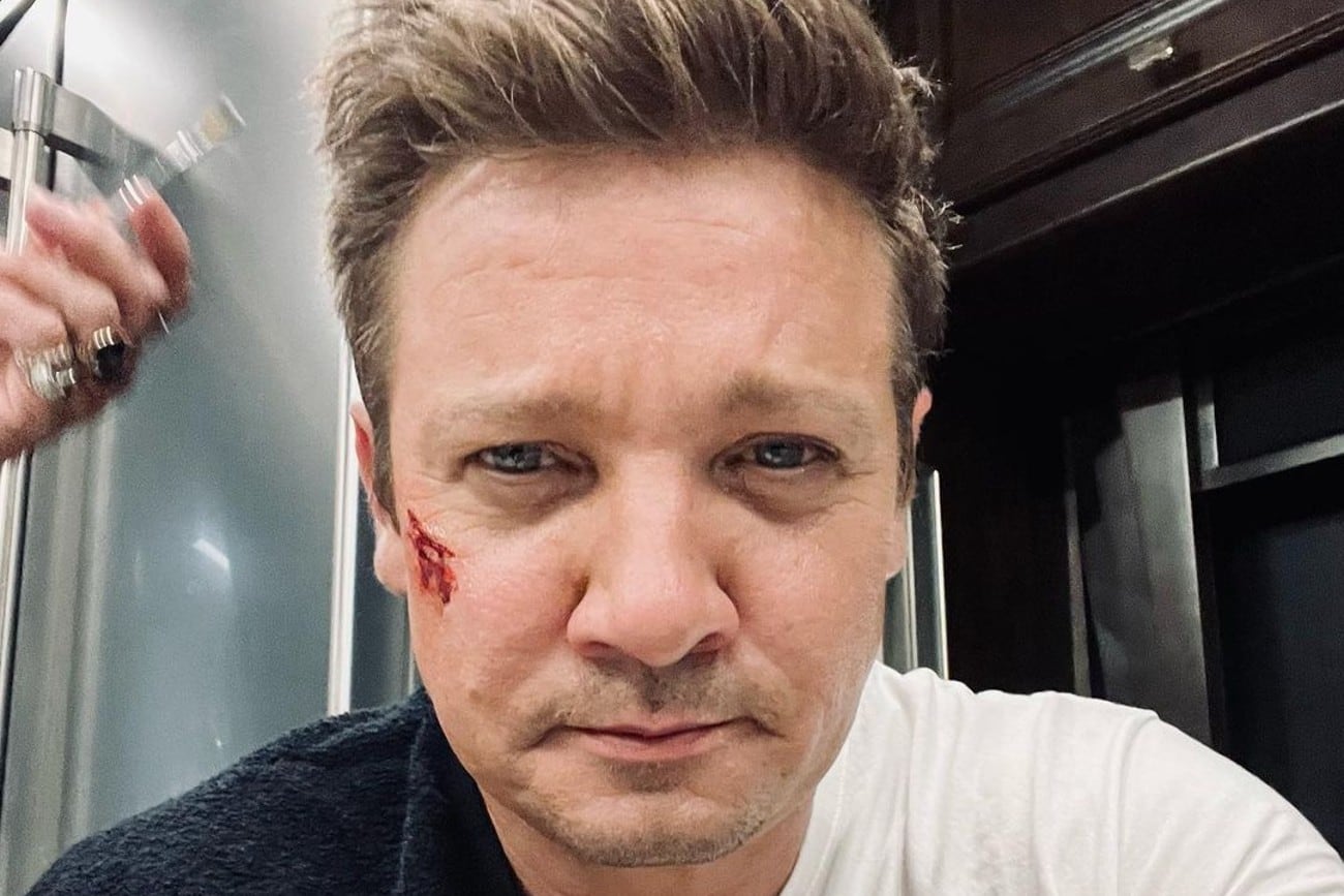 Jeremy Renner muestra una pequeña lastimadura en su rostro. El accidente que sufrió el 1 de enero si le dejo secuelas graves. (Instagram @jeremyrenner)