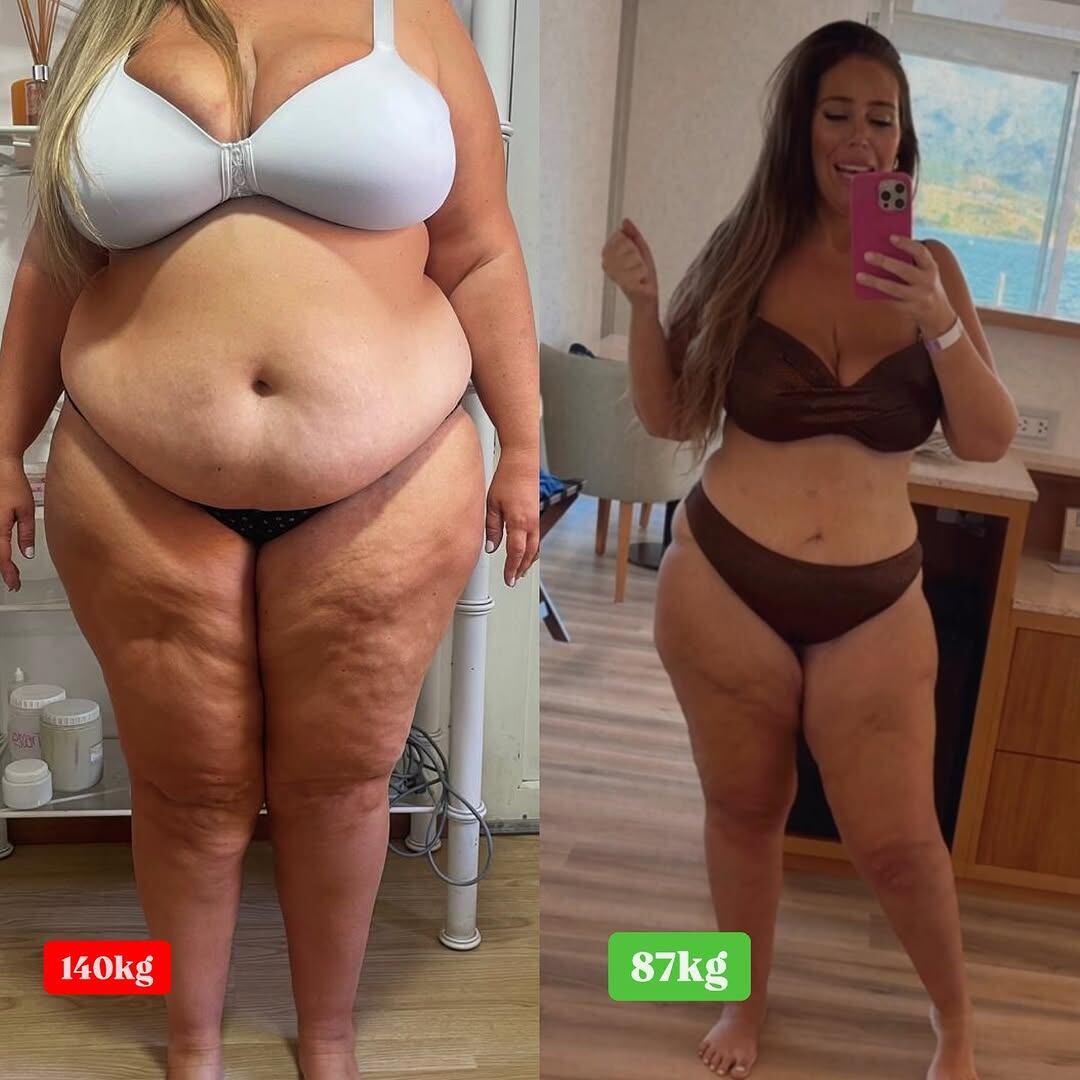 Tarrés mostró el antes y después tras bajar 53 kilos.