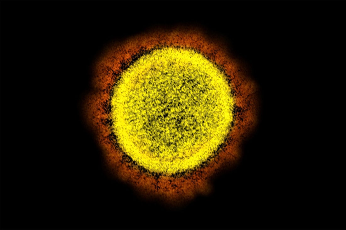 El coronavirus bajo el microscopio.