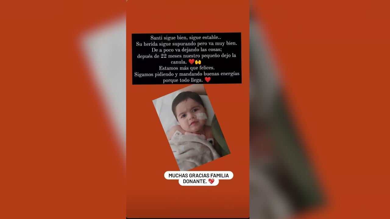 Santi, el pequeño sanjuanino que recibió un corazón está estable y esperan que no vuelva al quirófano