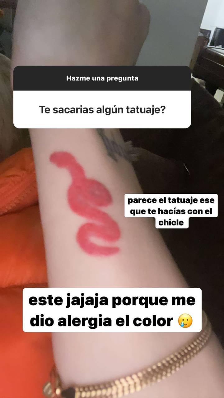 La cantante compartió que uno de sus tatuajes quedó mal por una reacción alérgica.