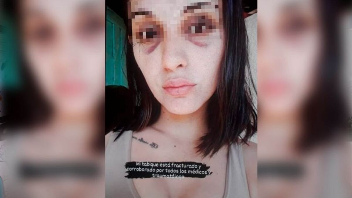 Fuerte testimonio de la joven agredida por el cantante de Labriegos: “Me encerró en el baño y me pegó”