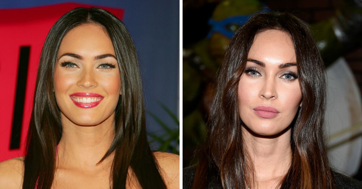 Megan Fox también ha sido señalada de realizarse una bichectomía.