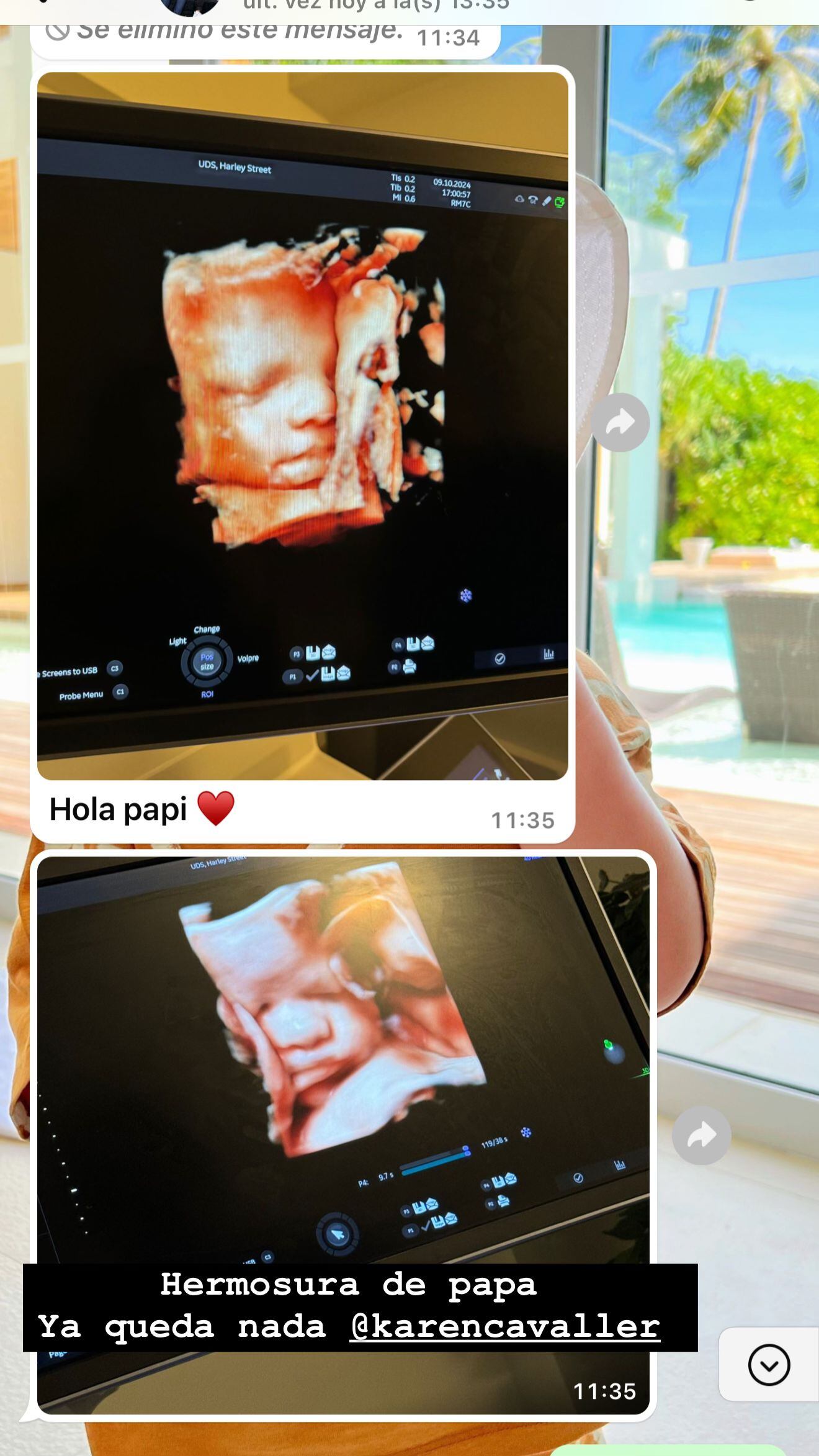 Las imágenes compartidas por el Cuti Romero en su historia de Instagram.