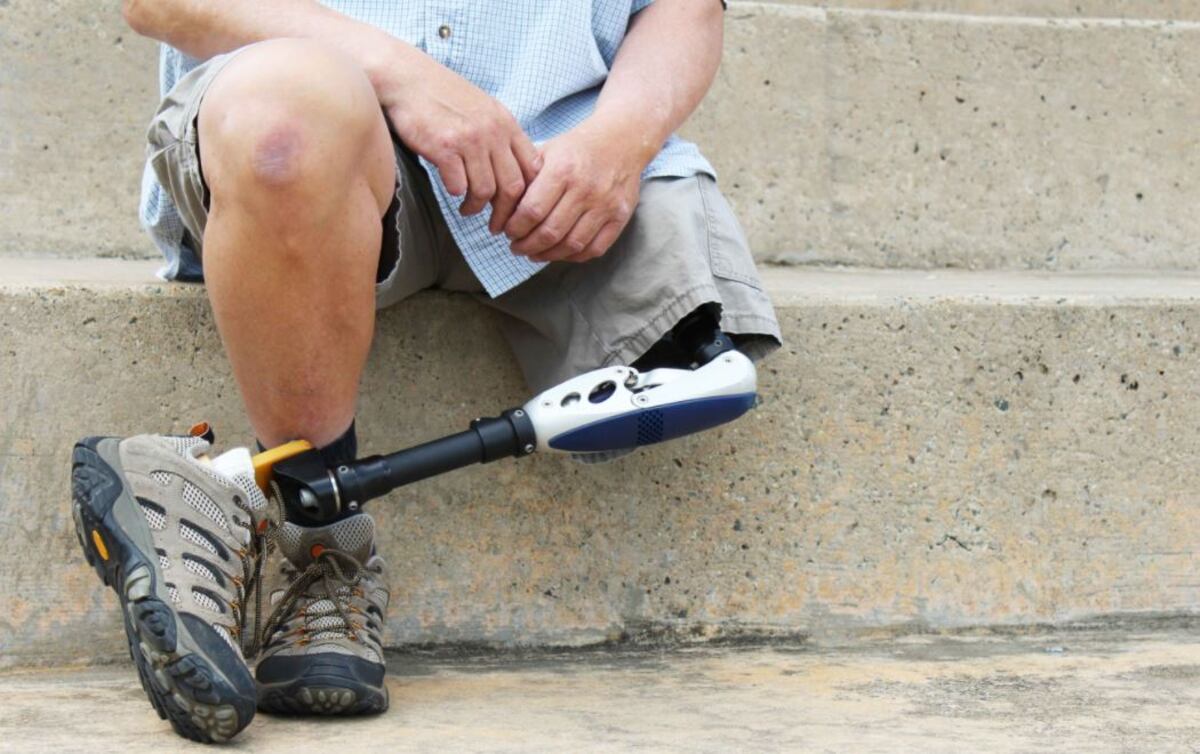 Le robaron la pierna ortopédica cuando estaba yendo a rehabilitación, y horas después se la devolvieron