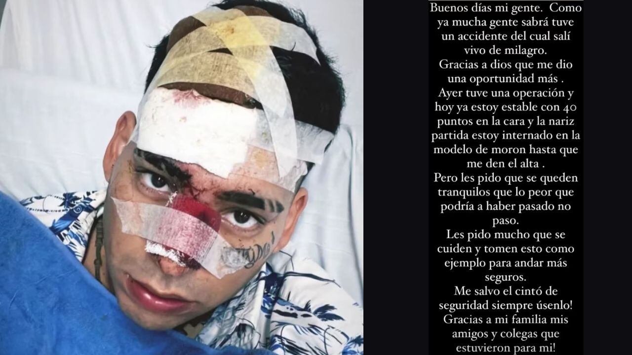 El cantante Kaleb Di Masi chocó contra un patrullero en Buenos Aires y tuvo que ser hospitalizado: “Estoy vivo de milagro”