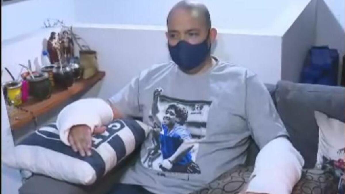 Córdoba: lo atacó un perro pitbull y lo dejó seriamente herido
