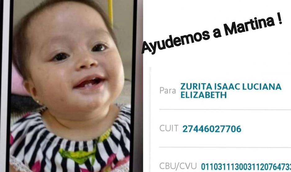 Martina, la beba de 11 meses internada en el Garrahan por padecer púrpura trombocitopenia.