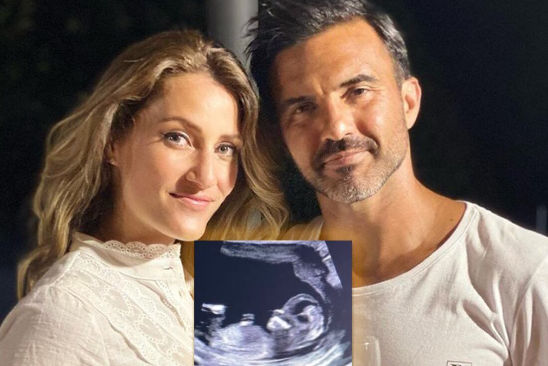 Mica Viciconte compartió la última ecografía de su hijo por nacer