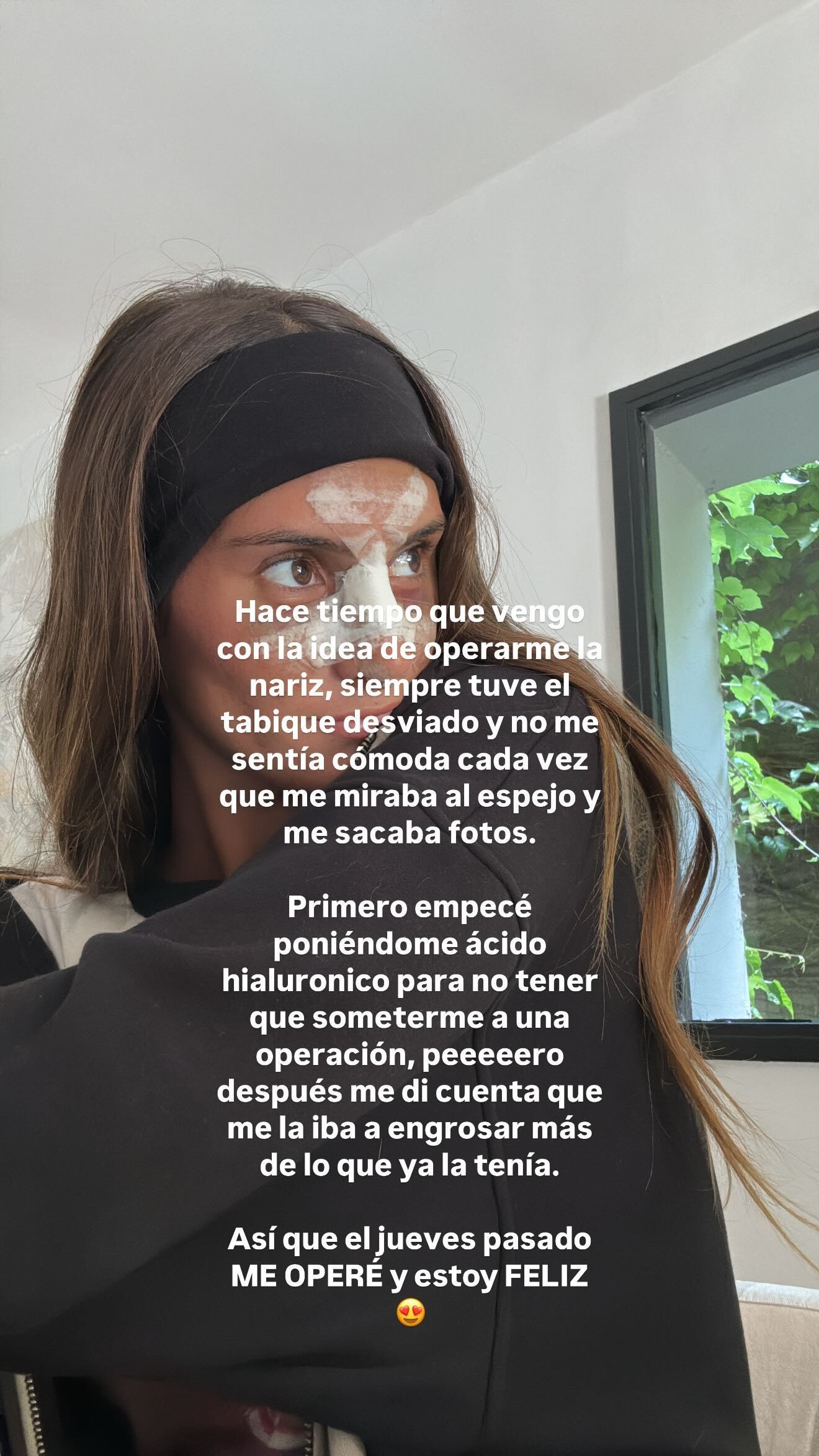 La influencer contó que se operó la nariz.