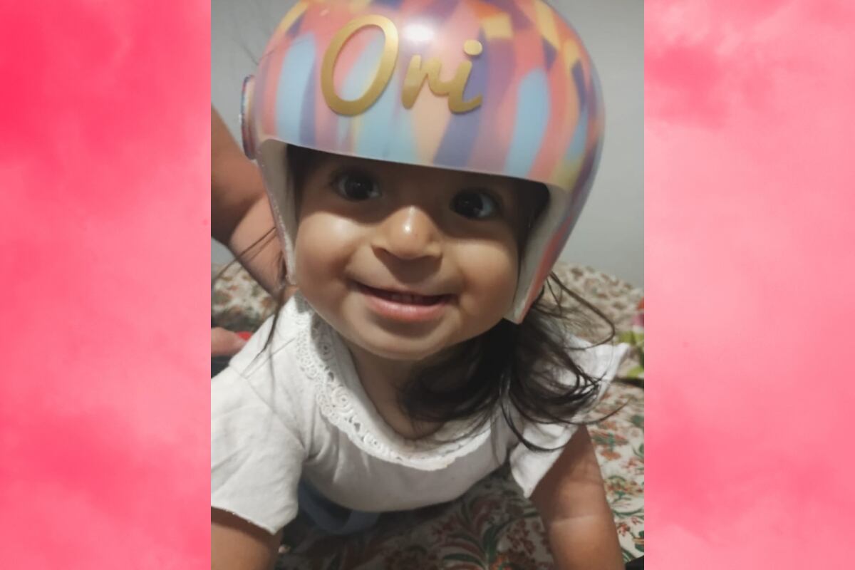 Gracias a la solidaridad de San Luis, Oriana ya tiene su órtesis craneal