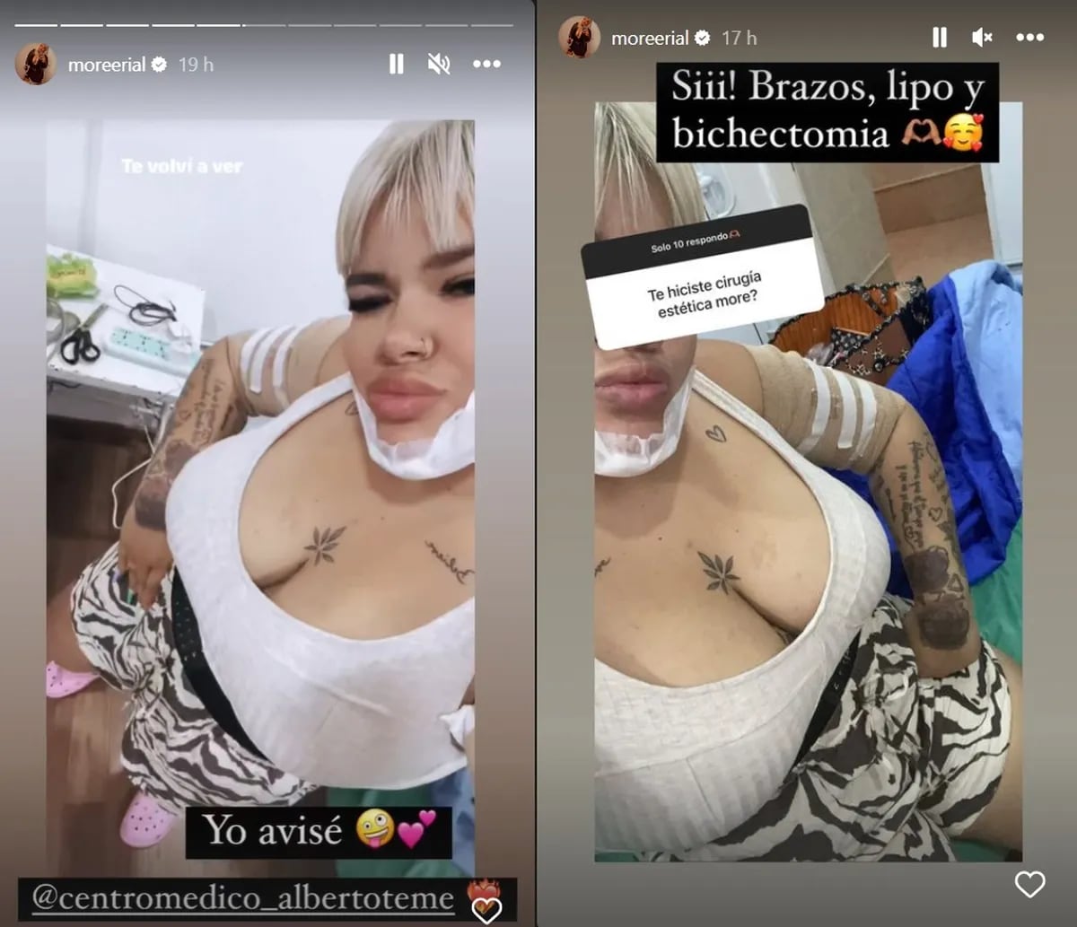 Reveló que retoques estéticos se realizó en las redes sociales