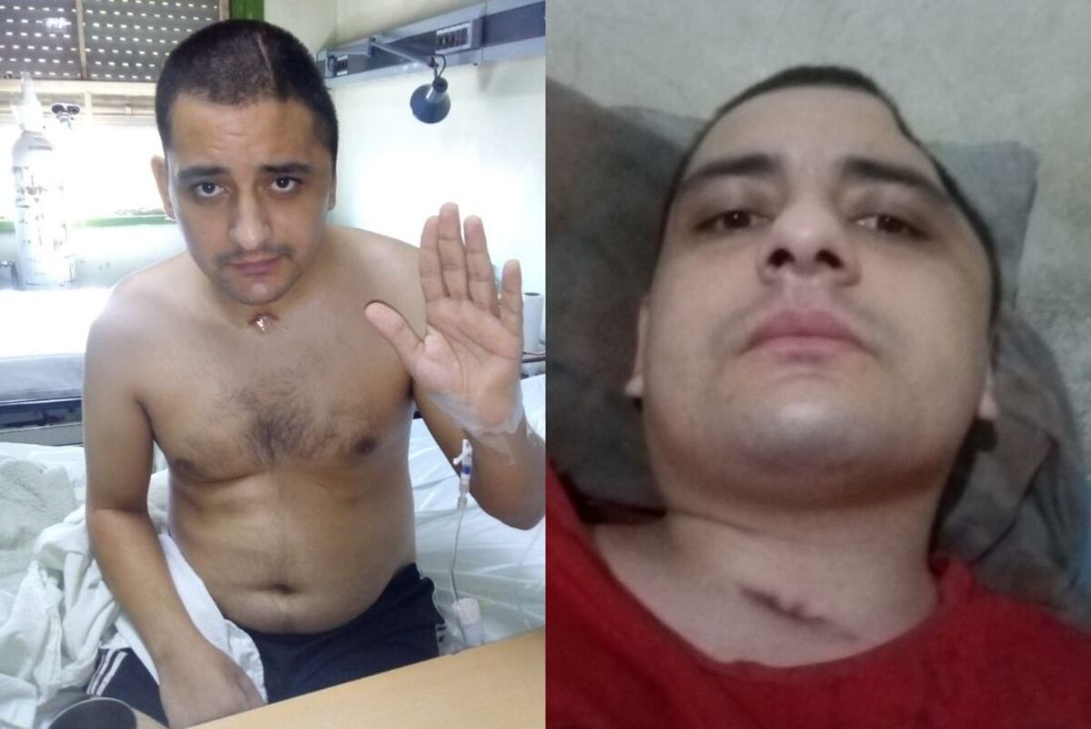 Fue atropellado, perdió parte de su cráneo y ofrece una importante recompensa para dar con el responsable