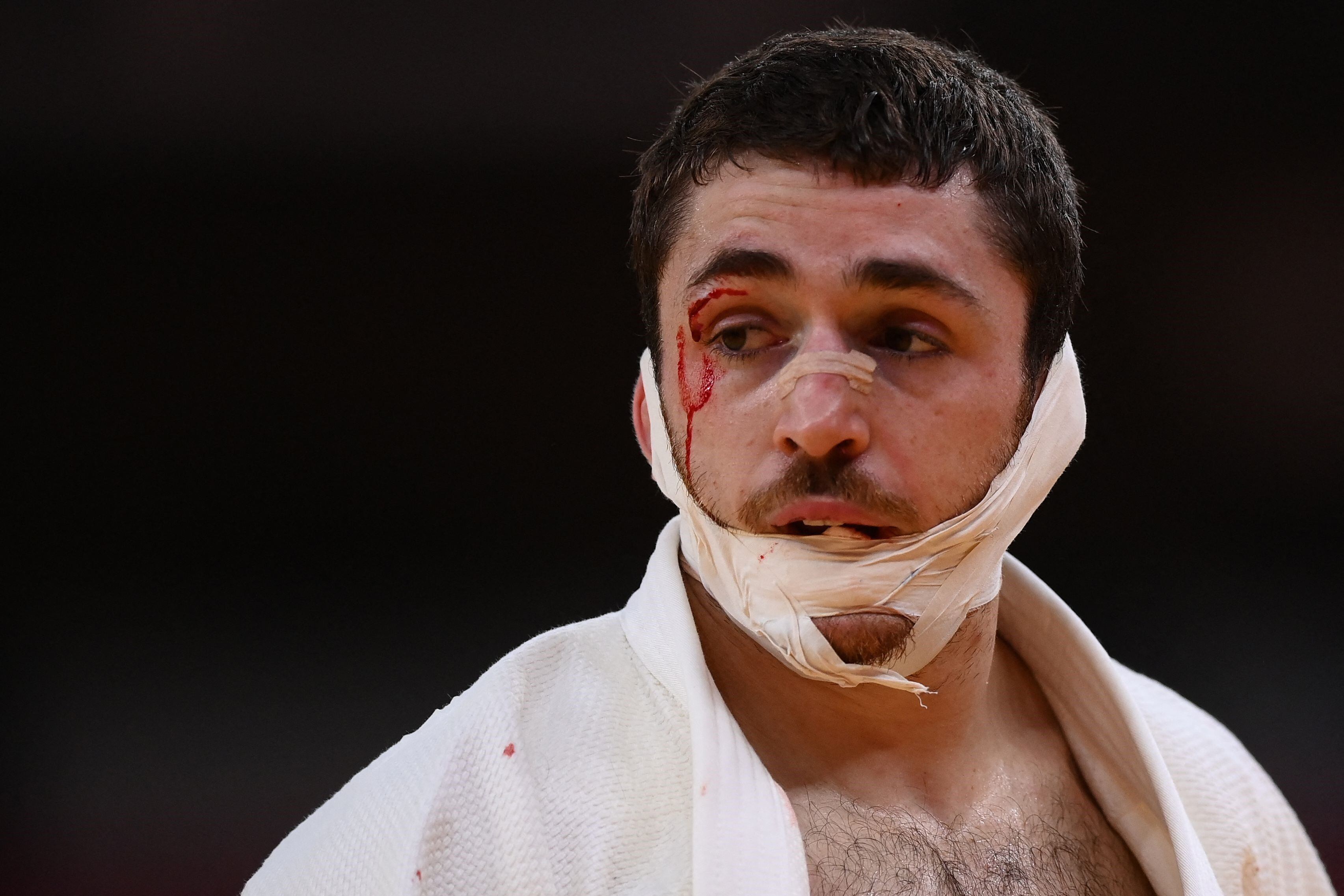 Así le quedó el rostro al judoca español.