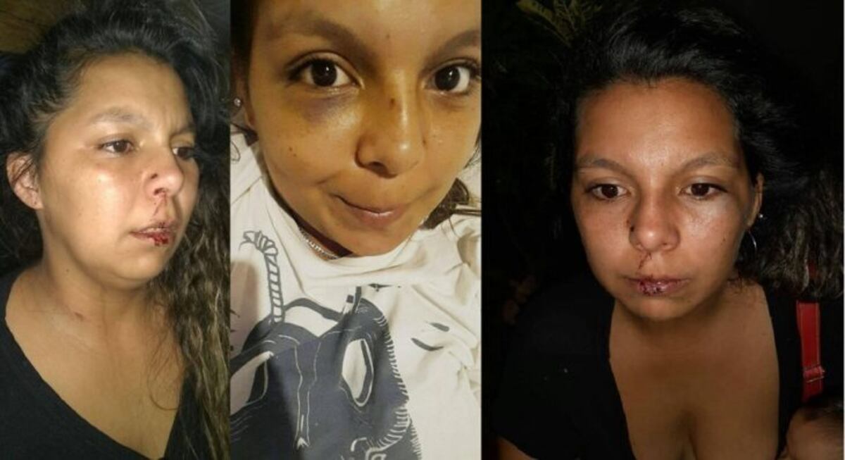 Violencia de género: una joven publicó un desesperado pedido de ayuda en las redes