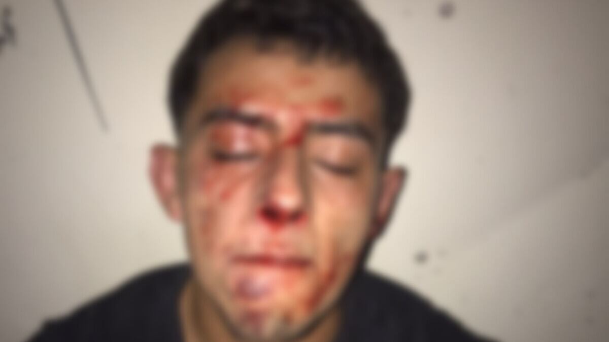Denunció una brutal golpiza dentro de un boliche de Saldán