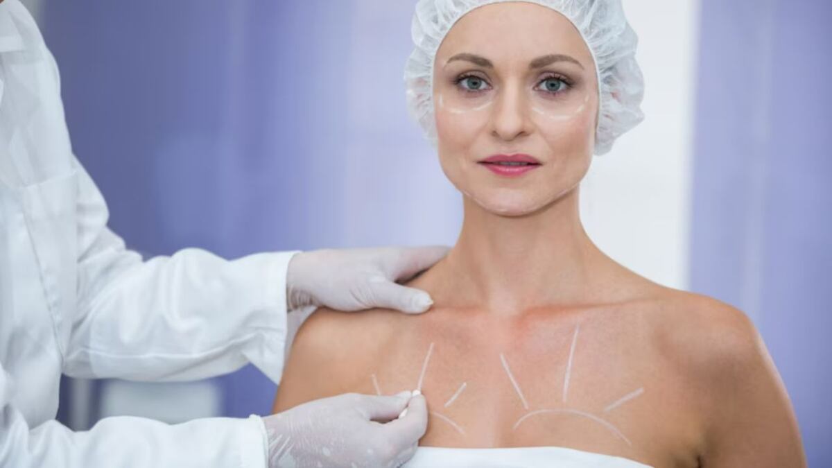 Ya no son los implantes de senos: cuál es la cirugía estética que ocupa el primer lugar