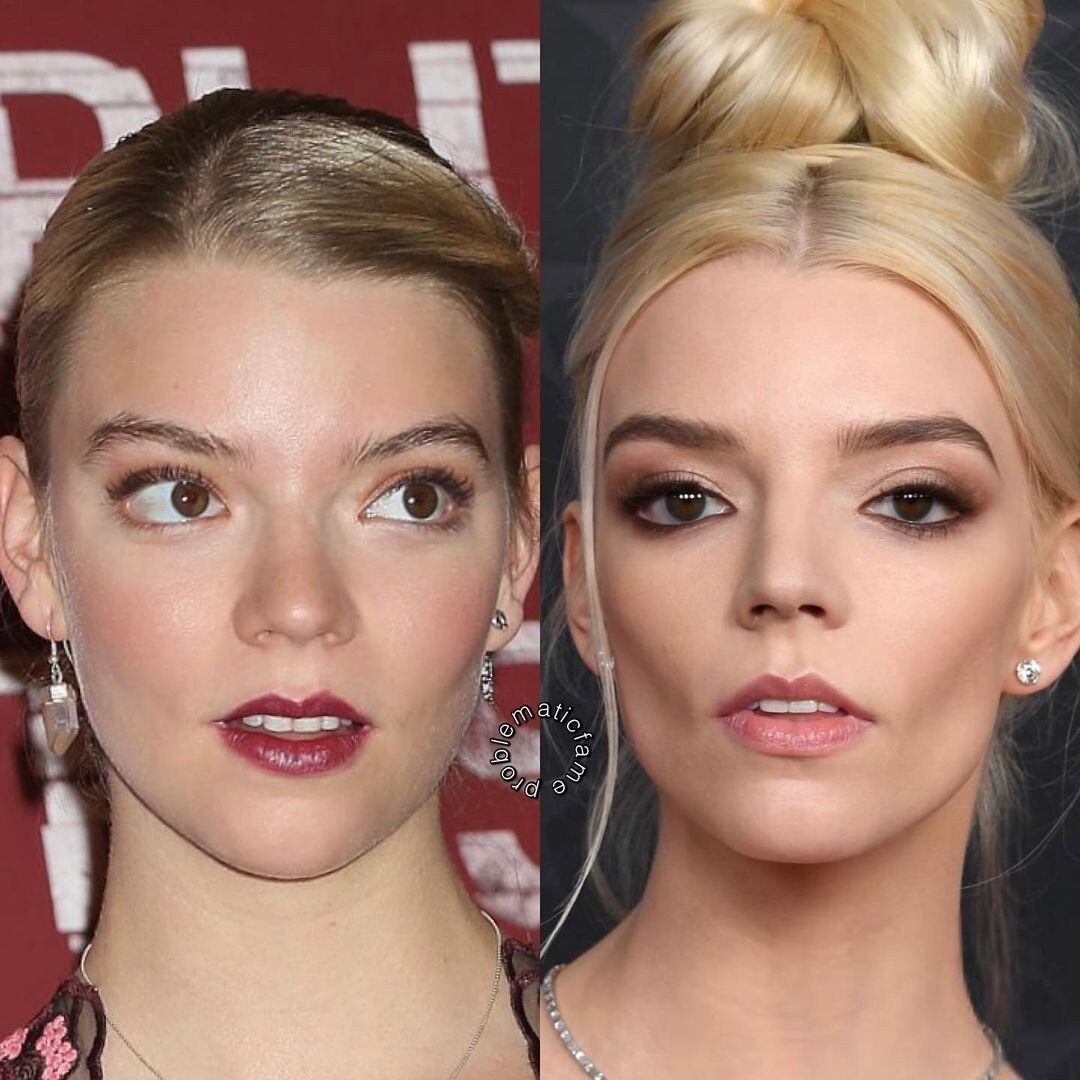 Un usuario de Instagram comparó el rostro de Anya Taylor-Joy en 2017 y ahora