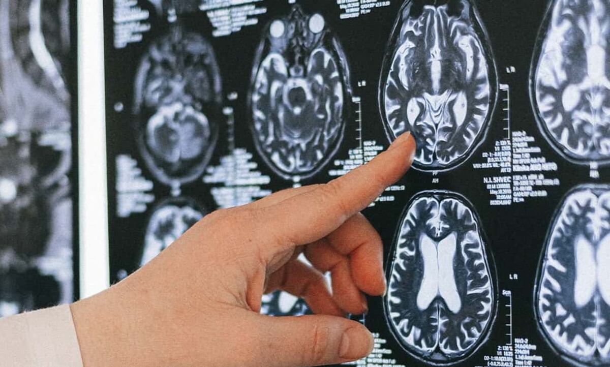 Prevención del Alzheimer en Córdoba: cuándo y dónde se harán el conversatorio