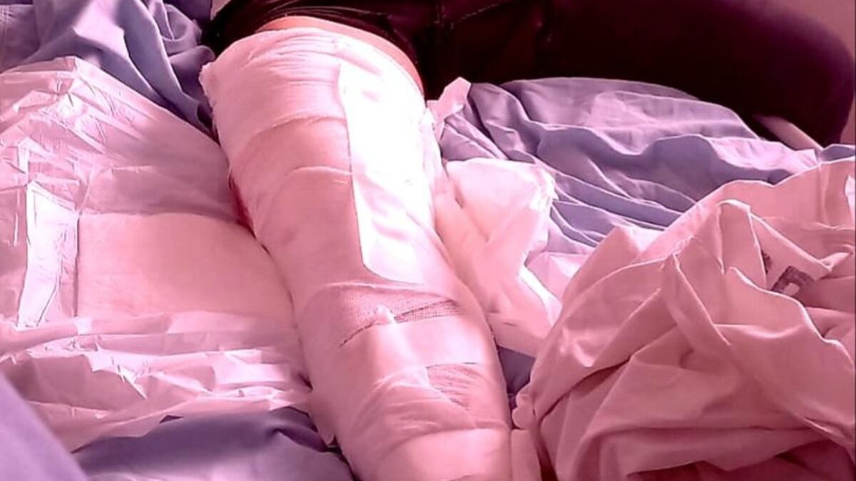 Un “delivery” fue asaltado en Córdoba, no se resistió y entregó todo pero le dispararon en la pierna