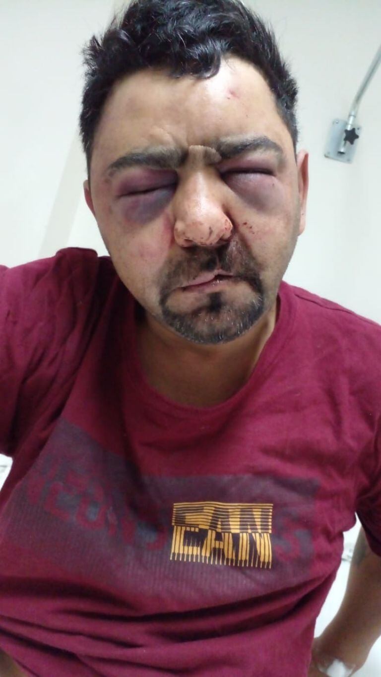 Denuncian que un hombre fue torturado y violado por policías de Puerto Deseado, Santa Cruz.