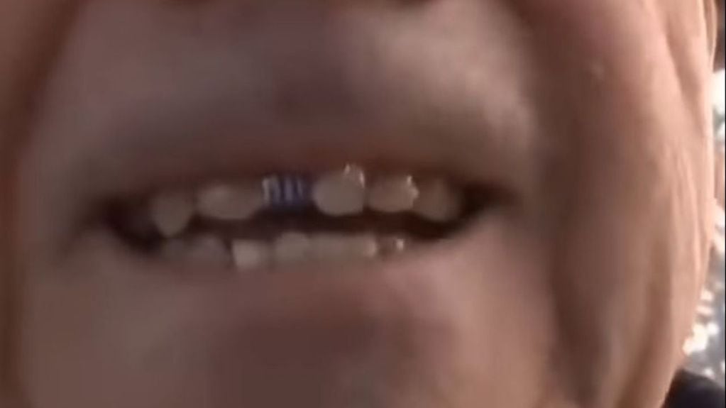 El diente albiazul del hincha más fiel.