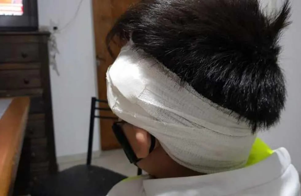 El menor sufrió una herida cortante en la cabeza, al ser atropellado por una moto, en Córdoba.