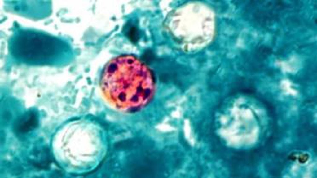La bacteria que causa la ciclospora (Foto: Global News).