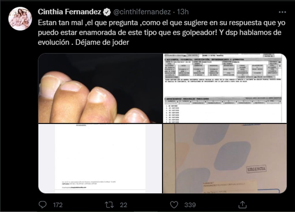 Cinthia Fernández y las pruebas de la violencia física que sufrió.