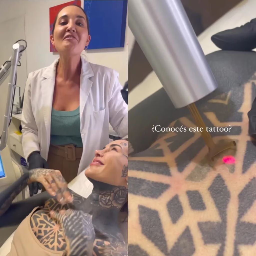 Cande Tinelli mostró el procedimiento para borrar uno de sus tatuajes.