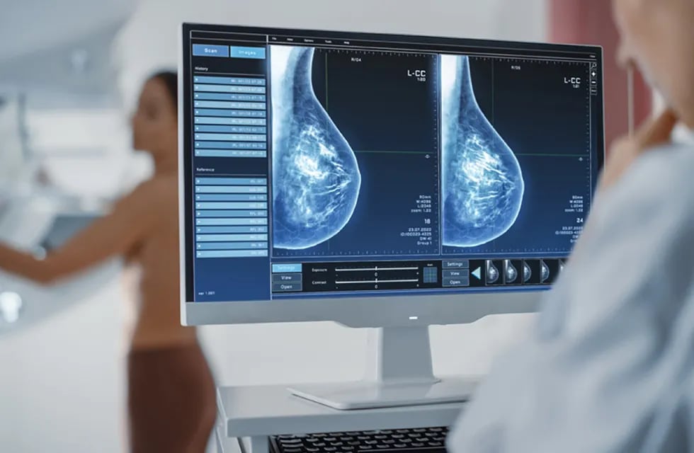 El aparato ayuda a las mujeres a transitar el cáncer de mama.