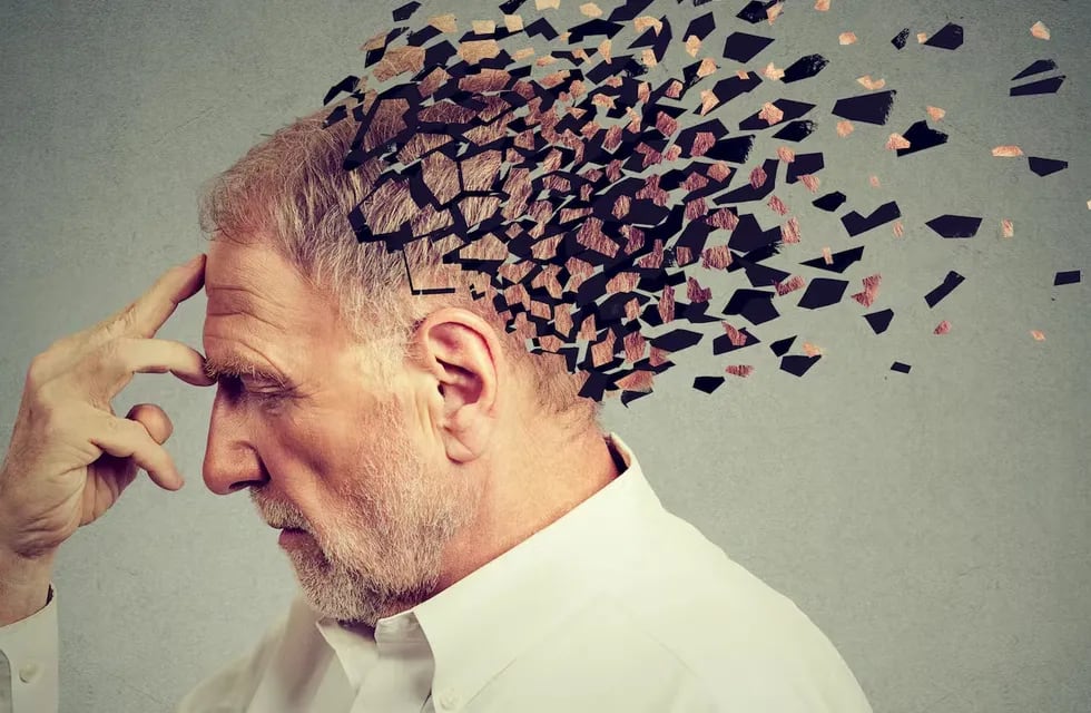 El alzheimer es una enfermedad progresiva que afecta a la memoria y otras importantes funciones mentales. | Imagen referencia