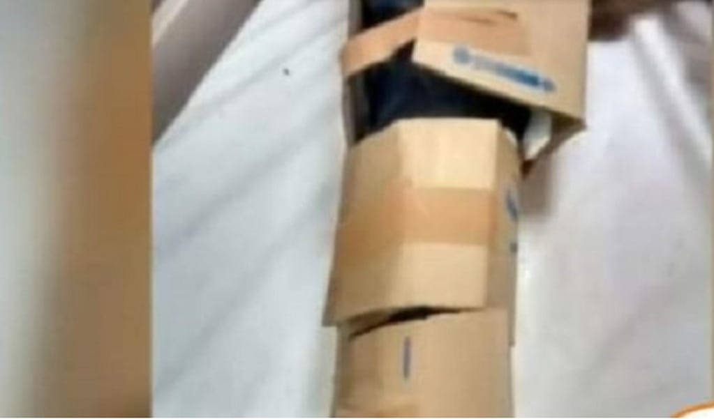 Un joven de Salta tuvo un accidente y lo “enyesaron” con cartón