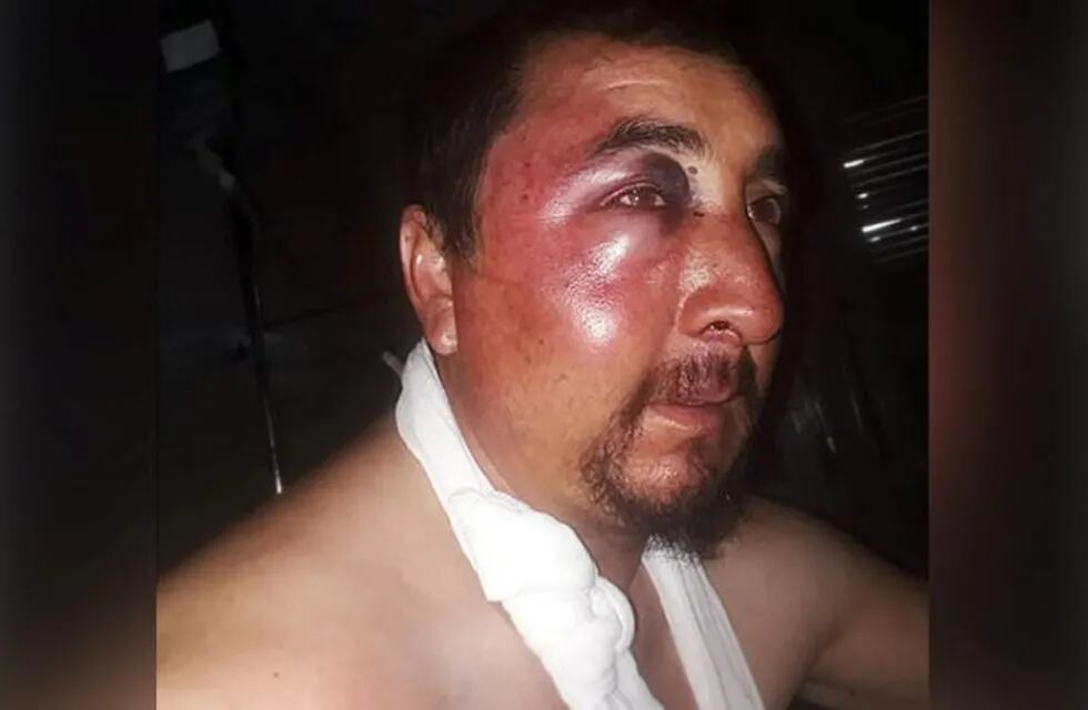 Puestero de Limay Mahuida golpeado por los hijos del intendente (AM 900)