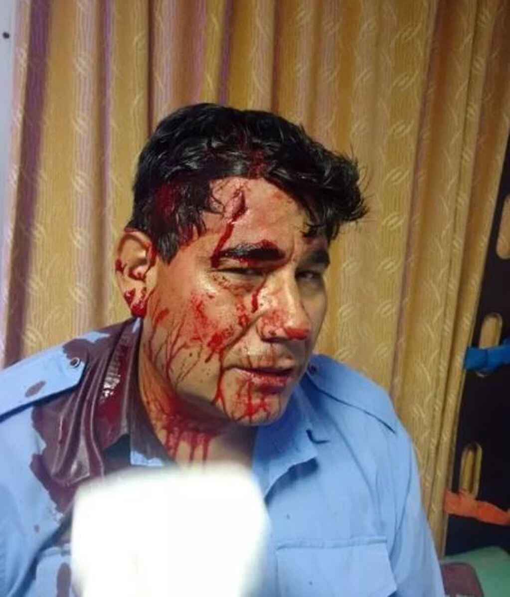 Un comisario recibió un piedrazo en la cabeza durante una protesta social en Resistencia. (Foto: Diario Chaco)