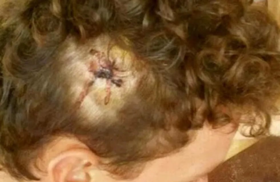 El hijo mayor de la familia terminó con una lesión en la cabeza tras el ataque.