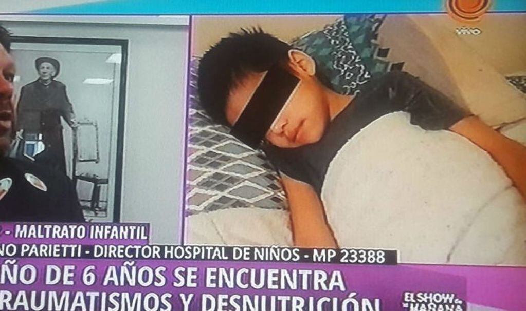 El niño maltratado está internado en el Hospital de Niños. Es de Unquillo, y sus padres están detenidos.