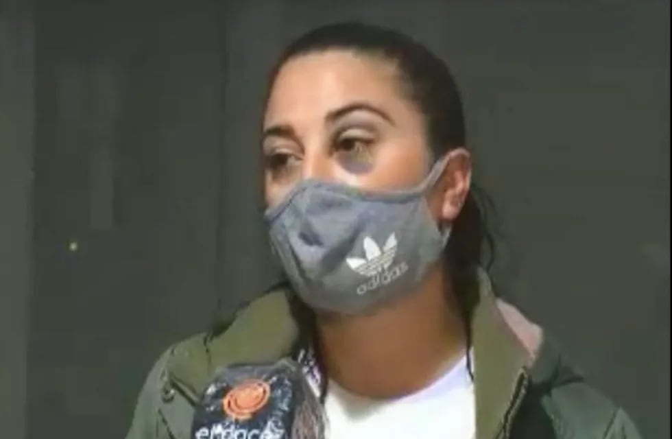 Yesica  Brusa, denuncia que un policía de Córdoba la golpeó en el rostro.