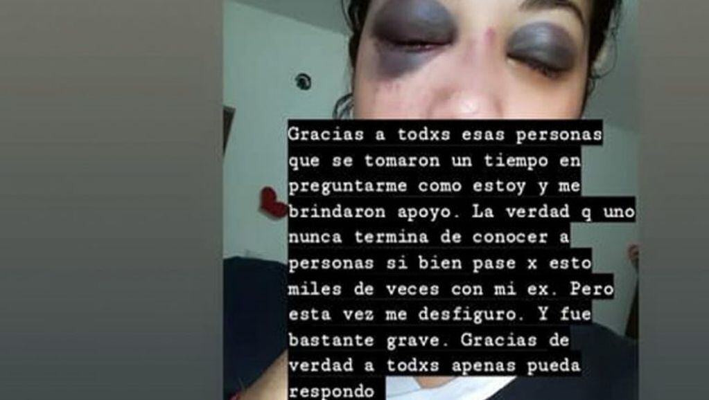 Melisa Rivera golpeada por su ex pareja