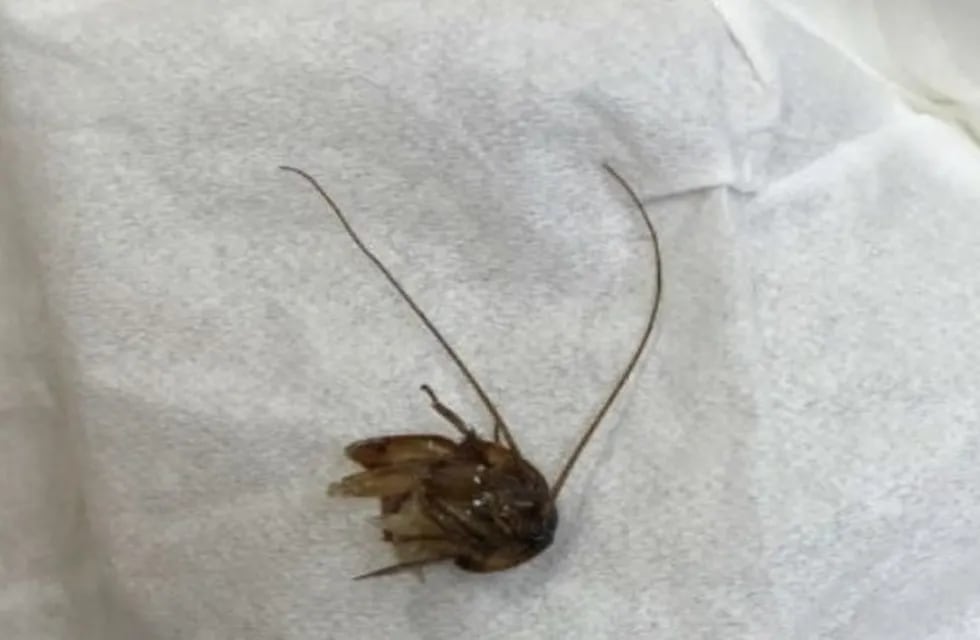 Una mujer vivió nueve días con una cucaracha en su oído. (Foto: Milenio)