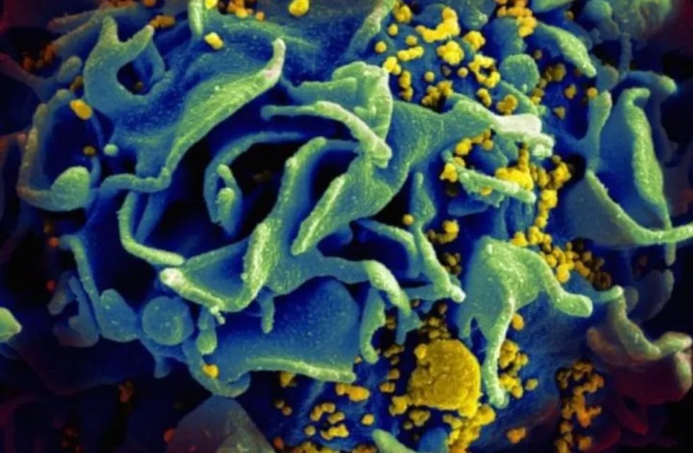 Imagen microscópica de una célula T infectada con VIH SALUD NIAID