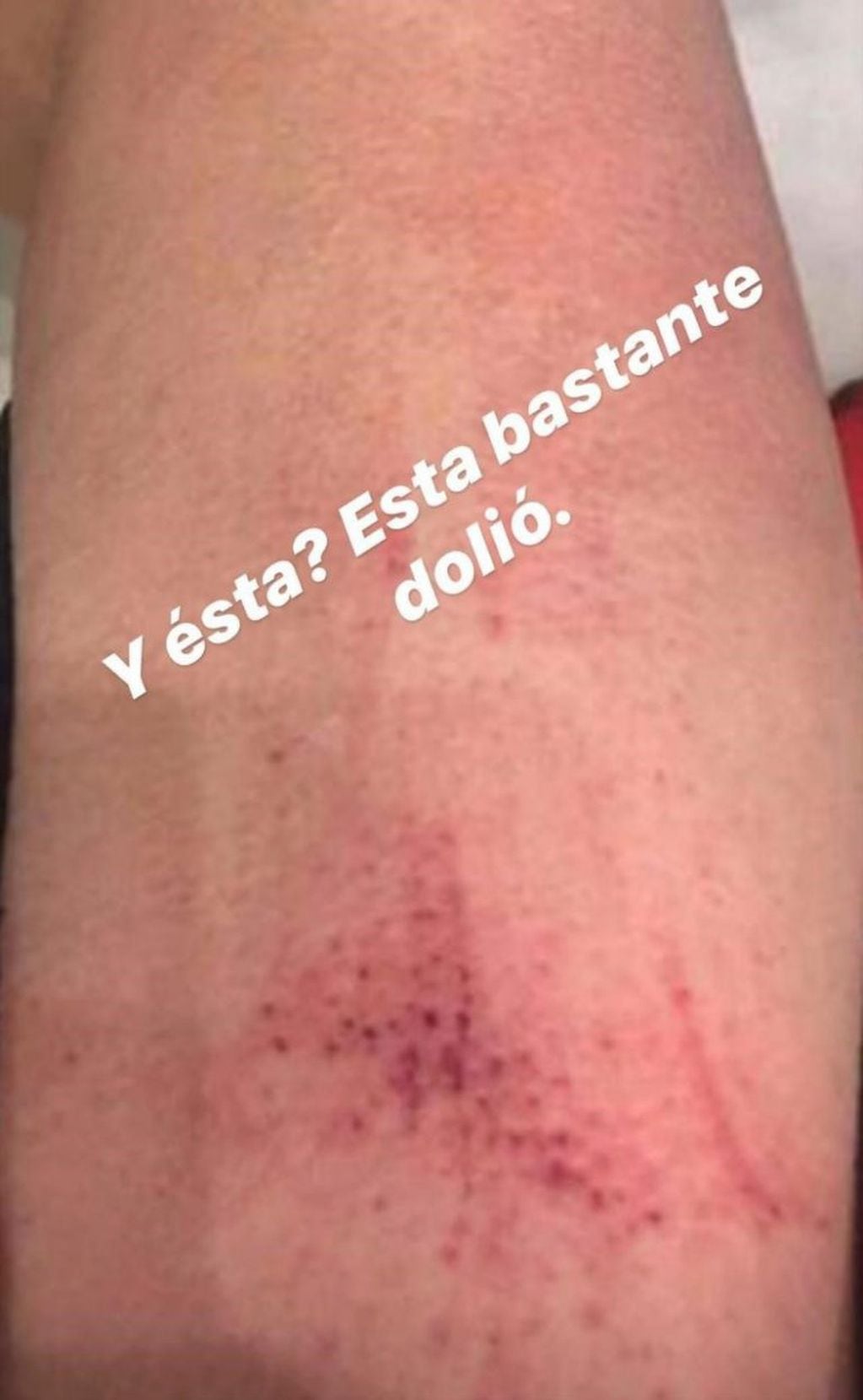 Miss Bolivia se separó de su marido y contó que sufrió violencia de género (Foto: Instagram)