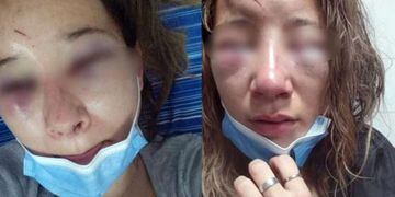 Una joven de 24 fue atacada brutalmente a la salida de un boliche.